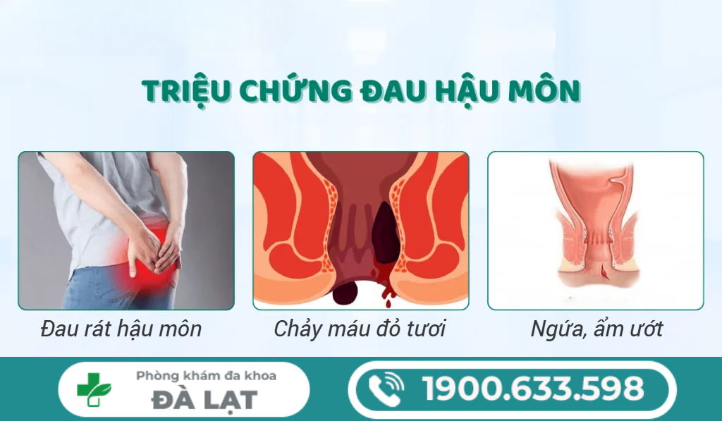 Hình ảnh minh họa
